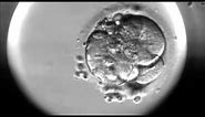 Timelapse of fertilisation of a human egg under the microscope