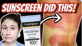 SUNSCREEN allergic reactions and rashes| Dr Dray