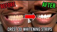 Using Crest 3D Whitestrips in 2022 *Honest Review* | How to Whiten Yellow Teeth