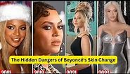 The Hidden Dangers of #Beyoncé's Skin Change: Skin Bleaching Exposed!