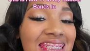 What do yall think about the pink rubber bands💕👀 #fypシ゚viral #braces #orthodontist #pinkbraces #flashyynaya #fypシ #painfulbraces #viral #bracescolors #pinkrubberbands #rubberbandsforbraces #wearyourrubberbands