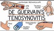 Understanding De Quervain’s Tenosynovitis (Mummy Thumb)