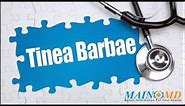 Tinea Barbae ¦ Treatment and Symptoms