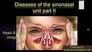 4-pathology of the sinonasal unit II