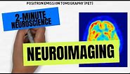 2-Minute Neuroscience: Neuroimaging