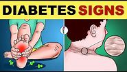 Diabetes Symptoms | Diabetes Mellitus | Type 2 Diabetes - Signs & Symptoms | Diabetes Warning Signs