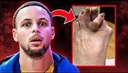 NBA Players With The NASTIEST FEET - Revision