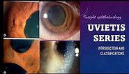 UVEITIS SERIES Classification, Types and Pathology of Uveitis