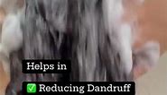 Anti Dandruff Shampoo | #dandruff #antidandruffshampoo