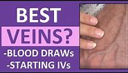 Best Veins for IV Insertion, Drawing Blood (Venipuncture Tips) in Nursing, Phlebotomy