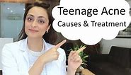 Teenage Acne: causes & treatment