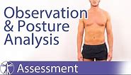 Observation and Posture Analysis