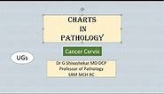 CANCER CERVIX Pathology RATS MBBS SRM Dr GSS University Exam Chart