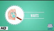 Wart, Causes, Signs and Symptoms, Causes, Diagnosis and Treatment.