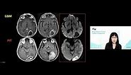 Comprehensive Brain Tumor Imaging - Soonmee Cha, MD