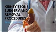 Kidney Stone Surgery & Removal Procedures - Dr. Brian D. Hale