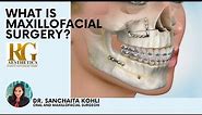 What is Oral and Maxillofacial Surgery? Dr Sanchaita Kohli - RG Aesthetics