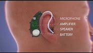 How Do Hearing Aids Work Video