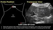 Abdominal, Gynecological & Obstetric Ultrasound Probe Positioning | Transducer Placement USG Scan