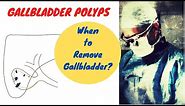 Gallbladder Polyps; When To Remove Gallbladder?