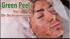 GREEN PEEL by Dr Schrammek (2022)- full procedure and client experience