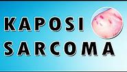 Kaposi Sarcoma Virus, Treatment, and Symptoms [Dermatology Course 34/60]