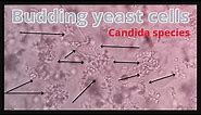 Budding yeast cells in urine | Candida Species | Pseudohyphae |@medicallabtechnologysajal6903