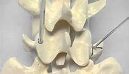 Pedicle Identification_spine surgery