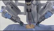 da Vinci® Robotic Surgical System
