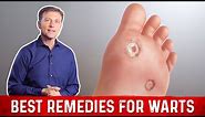 4 Best Wart Removal Remedies – Dr. Berg on Wart Treatment at Home