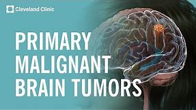 What Are Primary Malignant Brain Tumors?