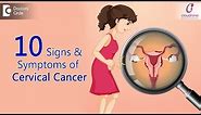 10 Signs & Symptoms of Cervical Cancer |Watch Out these Signs!-Dr.Sapna Lulla of Cloudnine Hospitals