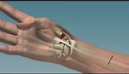 A Pain-Free Thumbs Up - Mayo Clinic