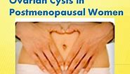 Ovarian Cysts in Postmenopausal Women