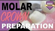 Molar Crown Preparation | Dental Crown Techniques