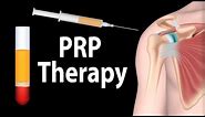 PRP Therapy Animation