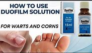 Duofilm Solution Uses||How to Get Rid of Warts, Corns, and Calluses with Duofilm Solution.