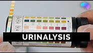 Urinalysis - OSCE Guide (old version) | UKMLA | CPSA