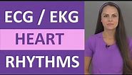 EKG Rhythms | ECG Heart Rhythms Explained - Comprehensive NCLEX Review