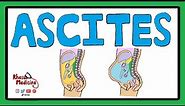 ASCITES - Serum Ascites Albumin Gradient (SAAG) | Ascites Pathophysiology | Ascites Causes