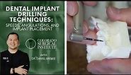 Dental Implant Drilling Techniques: Speeds, Angulations, and Implant Placement