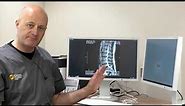 Top Tips for Back Pain with Dr Colin Natali - 10 Min