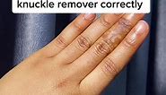 How to use your dark knuckle remover oils and creams correctly. . . . . . #darkknucklesremover #knuckles #skincarevideo #skincaretutorial #welearntogether #learnontiktok #foryou