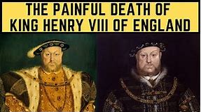 The PAINFUL Death Of King Henry VIII Of England