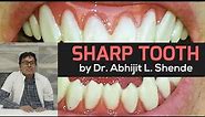 Sharp Tooth