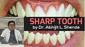 Sharp Tooth