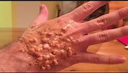 Incredible Trypophobia Hand! Real or Fake?