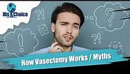 His Choice Vasectomy | How does a vasectomy procedure work?