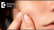 What can cause painful lump on cheek? - Dr. Srivats Bharadwaj