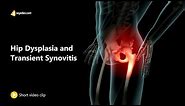 Hip Dysplasia and Transient Synovitis | Orthopedic Surgery Animation Video | V-Learning